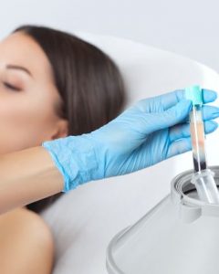 The Beauty Doctors - specjaliści medycyny estetycznej w Olsztynie polecają zabiegi z zastosowaniem osocza bogatopłytkowego